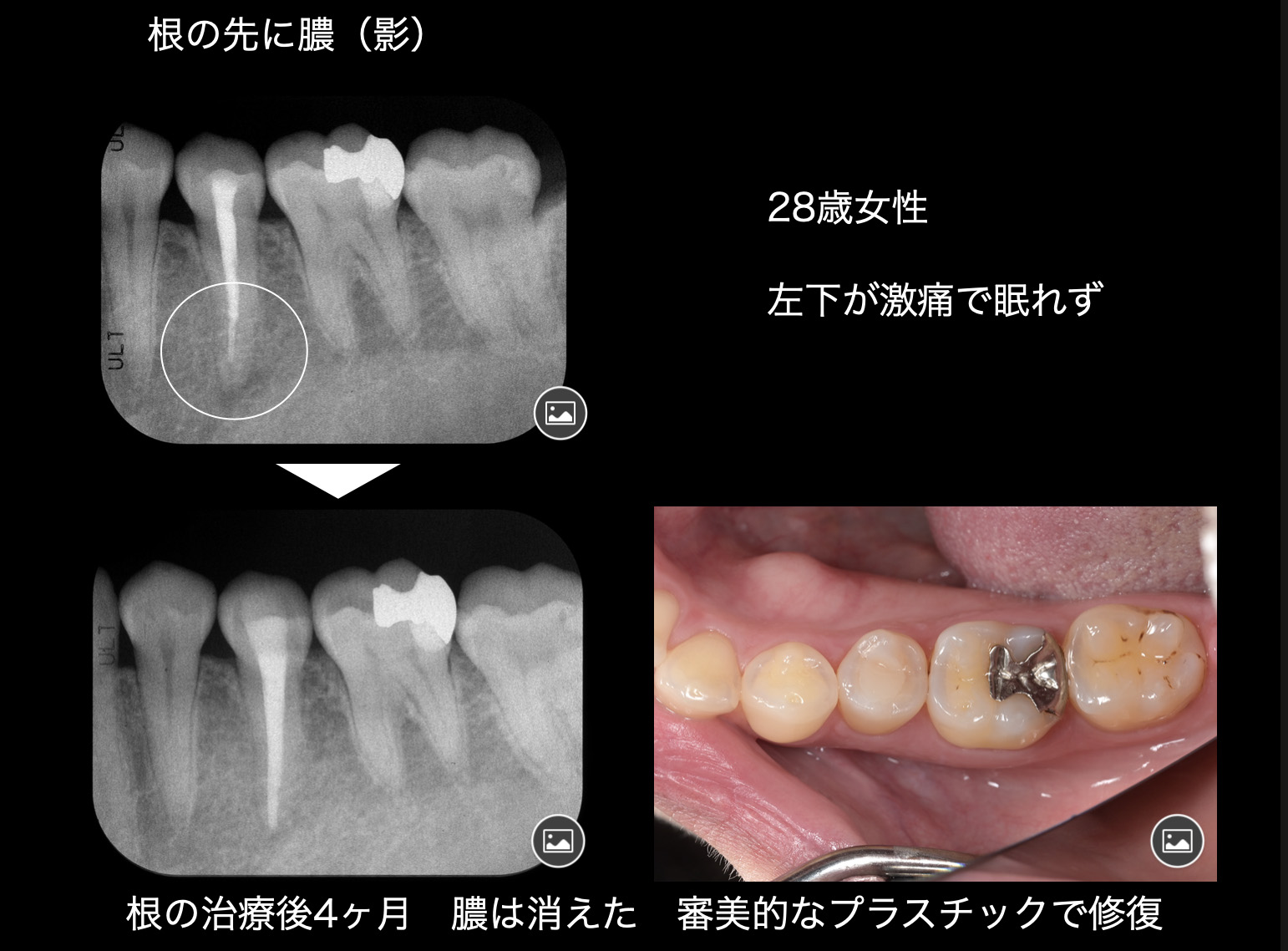 関口歯科 川越、歯医者、歯科医、歯周病、根管治療、入れ歯（義歯）、審美歯科・セラミック治療、自由診療