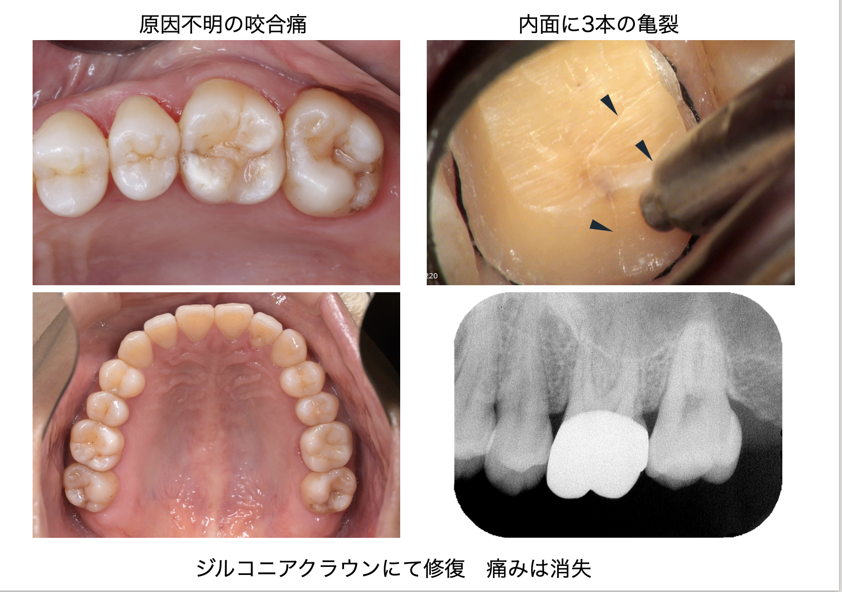 関口歯科 川越、歯医者、歯科医、歯周病、根管治療、入れ歯（義歯）、審美歯科・セラミック治療、自由診療