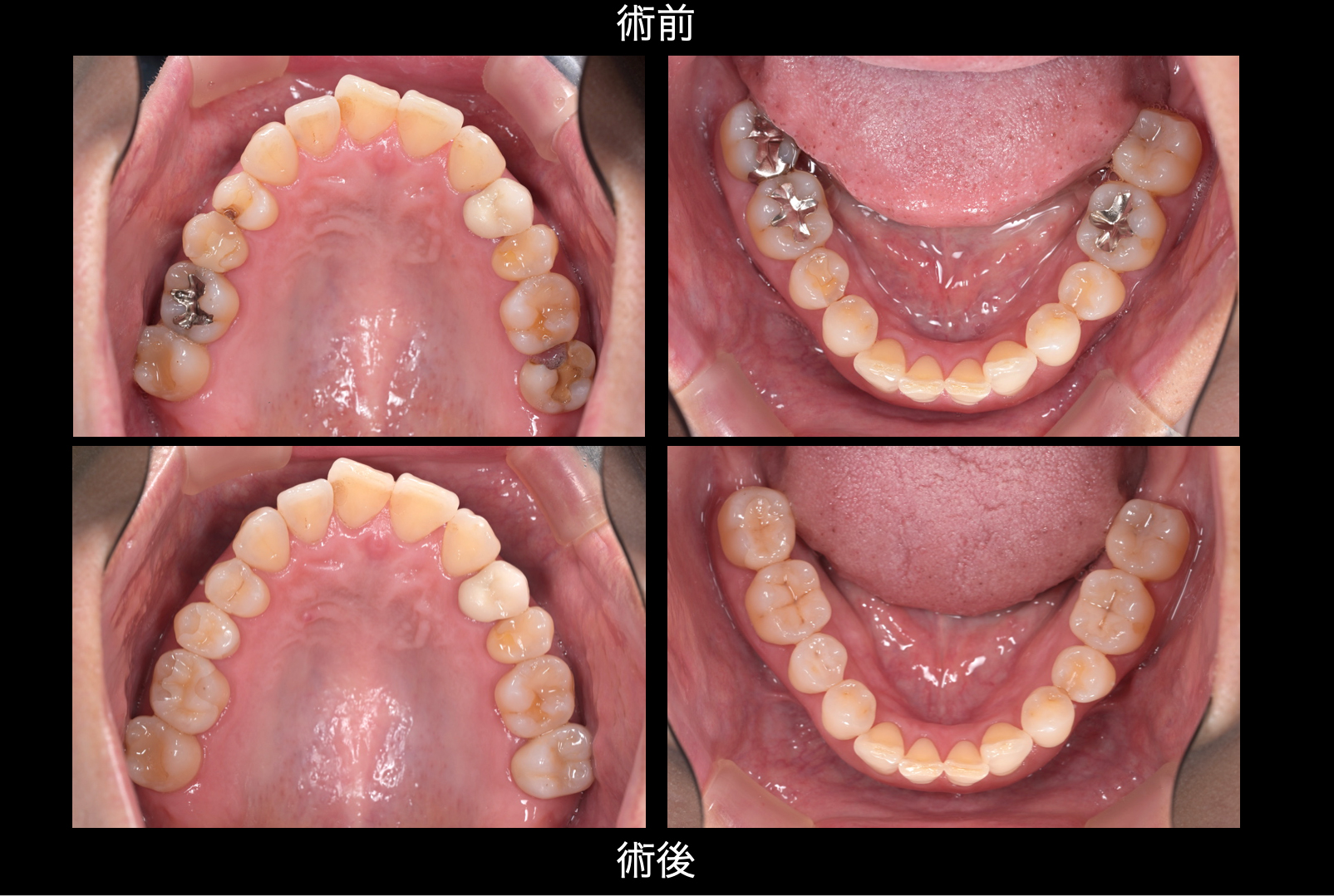 関口歯科 川越、歯医者、歯科医、歯周病、根管治療、入れ歯（義歯）、審美歯科・セラミック治療、自由診療