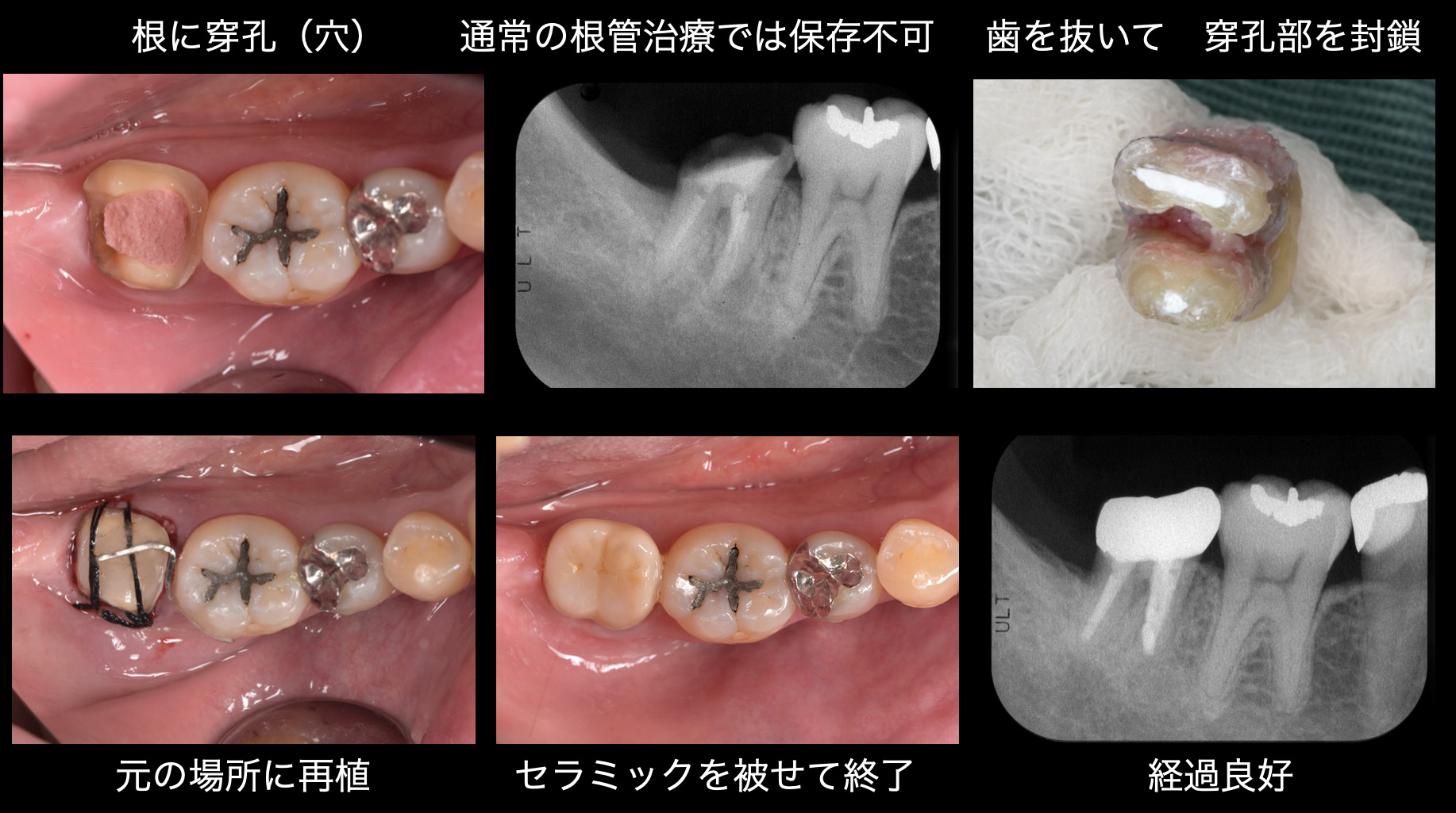 関口歯科 川越、歯医者、歯科医、歯周病、根管治療、入れ歯（義歯）、審美歯科・セラミック治療、自由診療