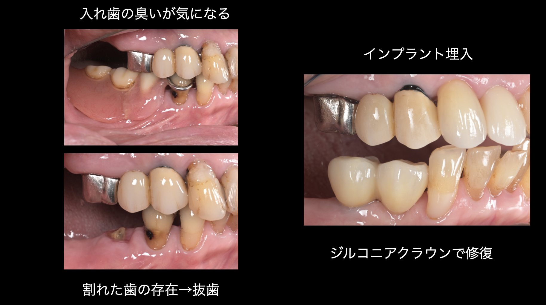関口歯科 川越、歯医者、歯科医、歯周病、根管治療、入れ歯(義歯)、審美歯科・セラミック治療、自由診療