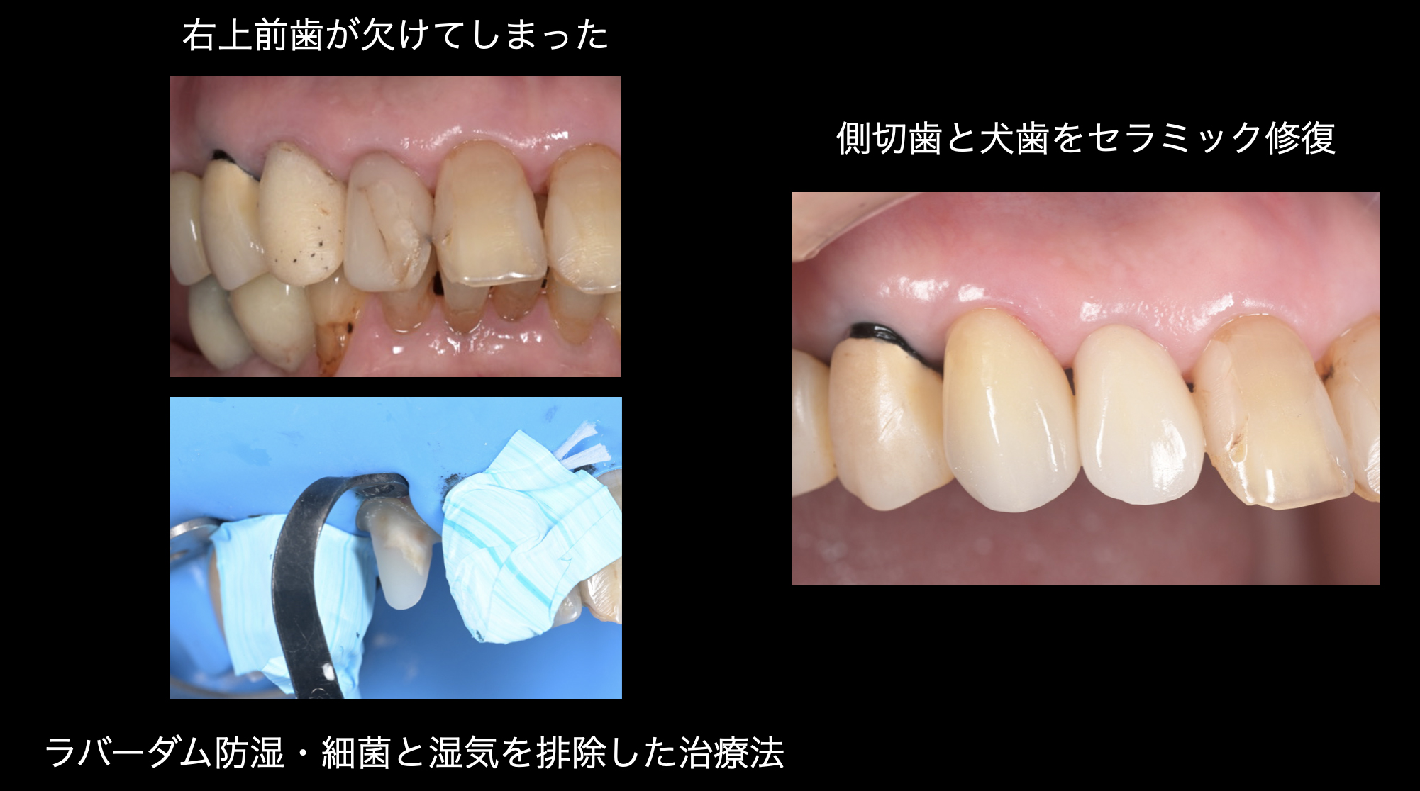関口歯科 川越、歯医者、歯科医、歯周病、根管治療、入れ歯（義歯）、審美歯科・セラミック治療、自由診療