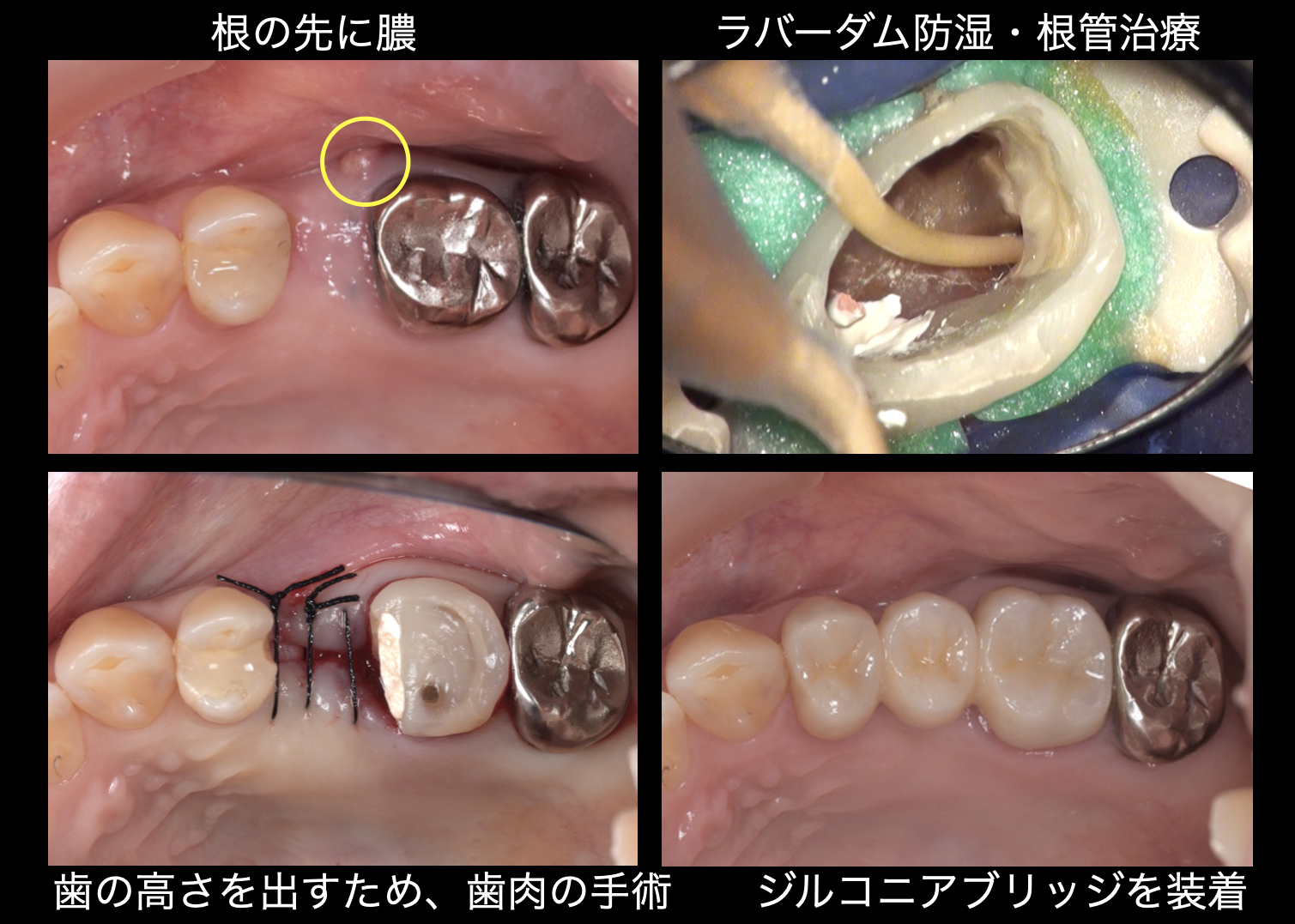 関口歯科 川越、歯医者、歯科医、歯周病、根管治療、入れ歯（義歯）、審美歯科・セラミック治療、自由診療