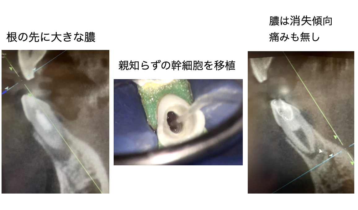 関口歯科 川越、歯医者、歯科医、歯周病、根管治療、入れ歯（義歯）、審美歯科・セラミック治療、自由診療