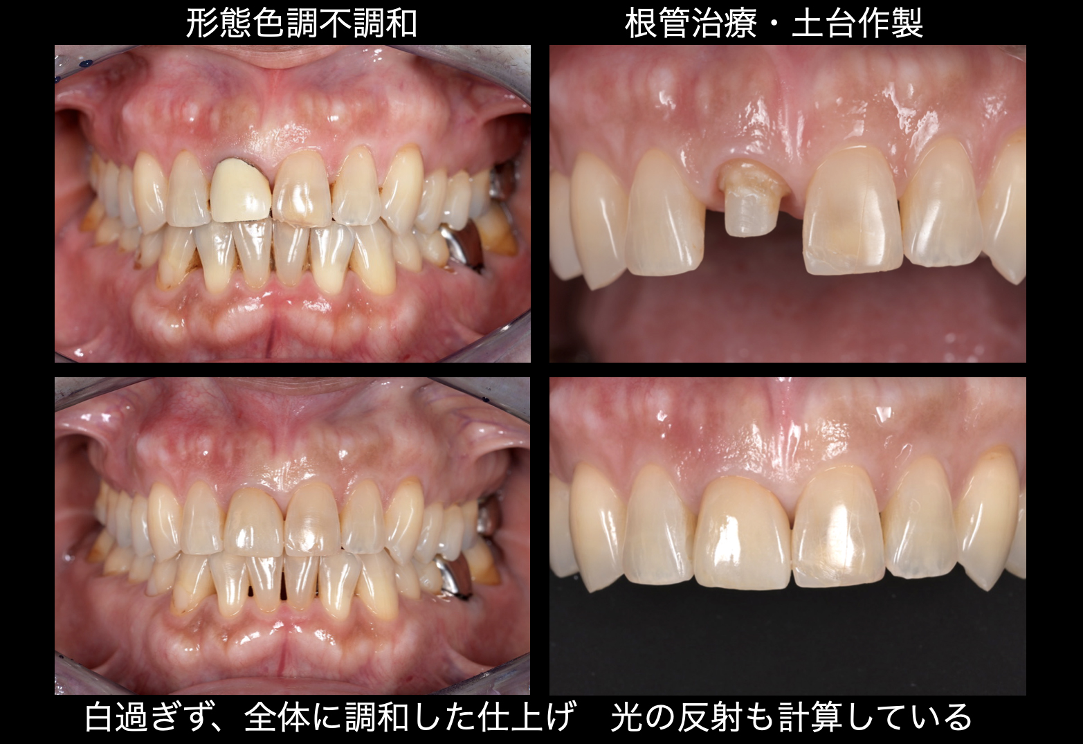 関口歯科 川越、歯医者、歯科医、歯周病、根管治療、入れ歯（義歯）、審美歯科・セラミック治療、自由診療
