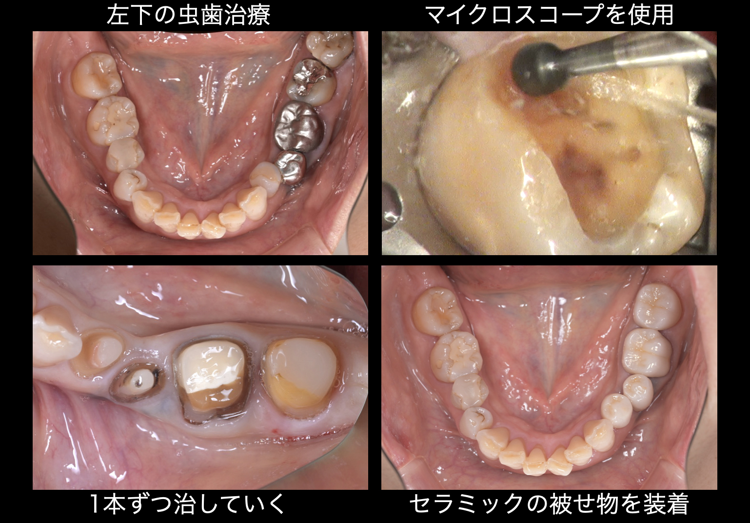 関口歯科 川越、歯医者、歯科医、歯周病、根管治療、入れ歯（義歯）、審美歯科・セラミック治療、自由診療