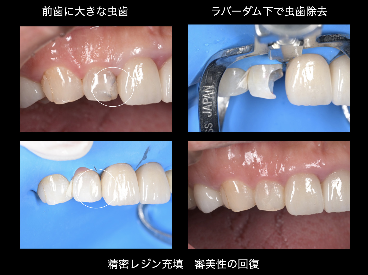 関口歯科 川越、歯医者、歯科医、歯周病、根管治療、入れ歯（義歯）、審美歯科・セラミック治療、自由診療