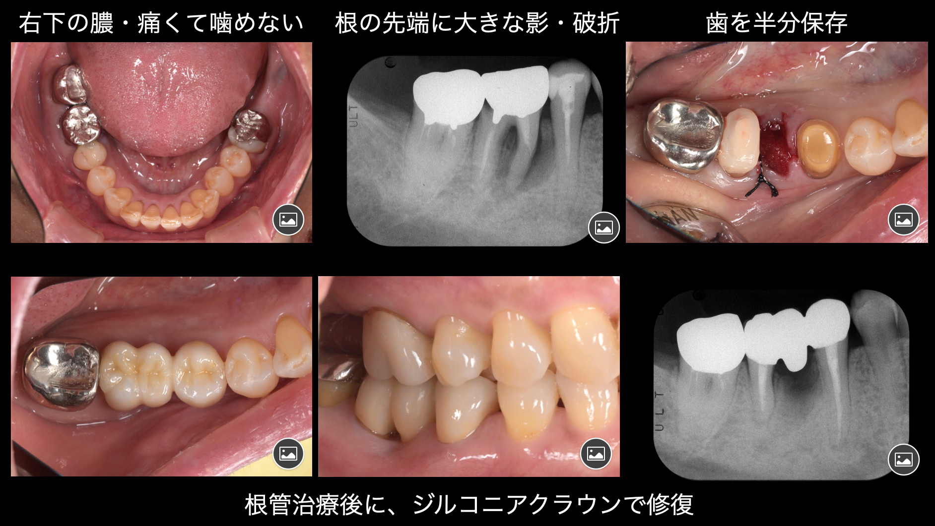 関口歯科 川越、歯医者、歯科医、歯周病、根管治療、入れ歯（義歯）、審美歯科・セラミック治療、自由診療