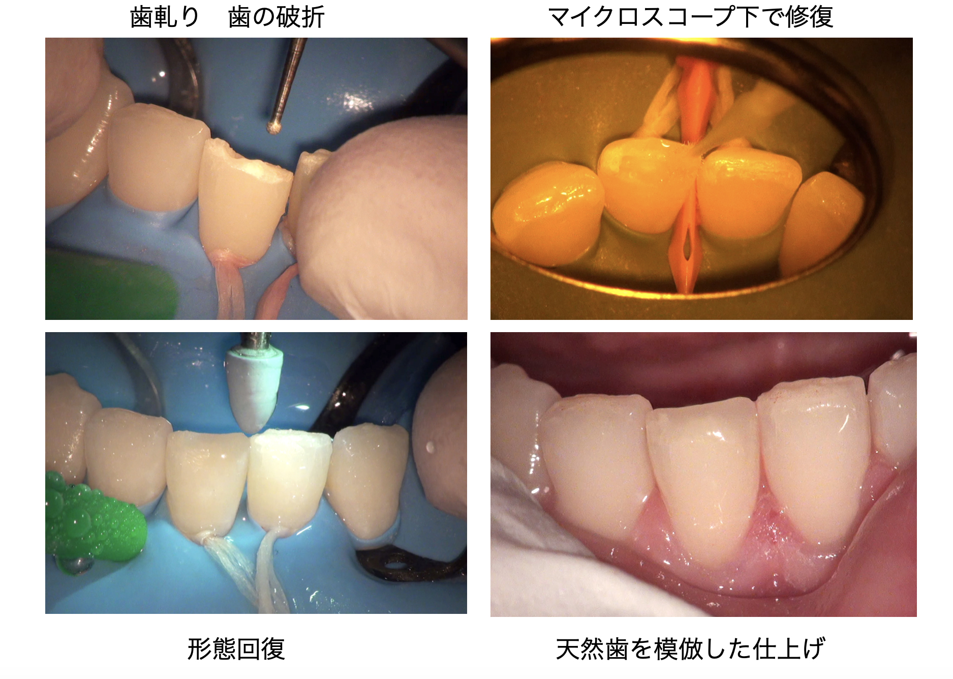 関口歯科 川越、歯医者、歯科医、歯周病、根管治療、入れ歯(義歯)、審美歯科・セラミック治療、自由診療