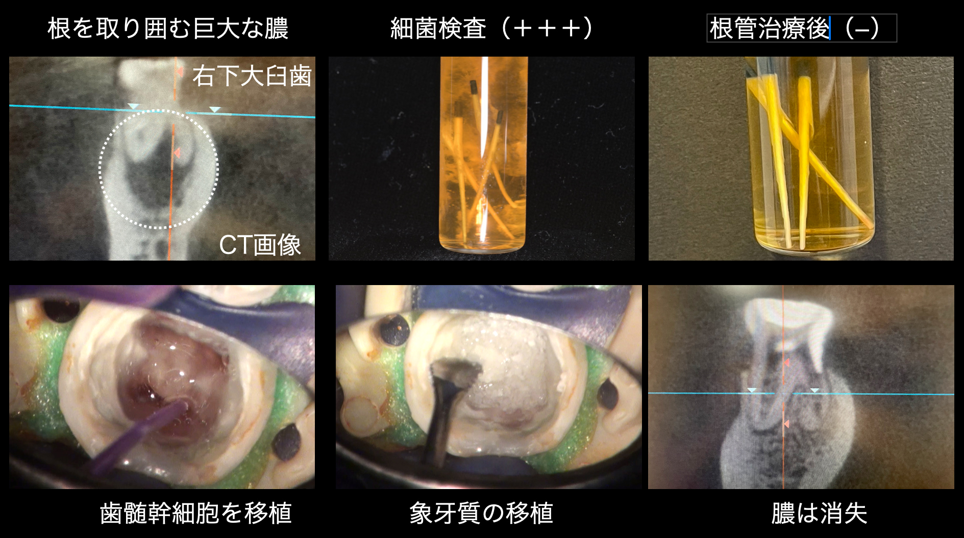 関口歯科 川越、歯医者、歯科医、歯周病、根管治療、入れ歯(義歯)、審美歯科・セラミック治療、自由診療