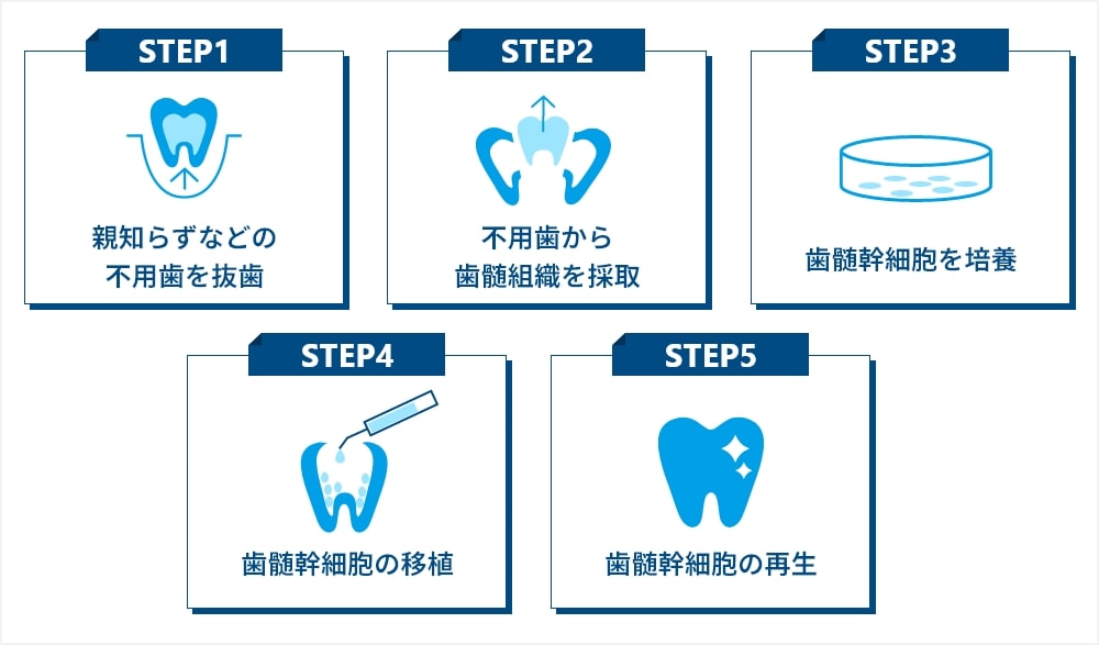 歯髄再生治療の仕組み