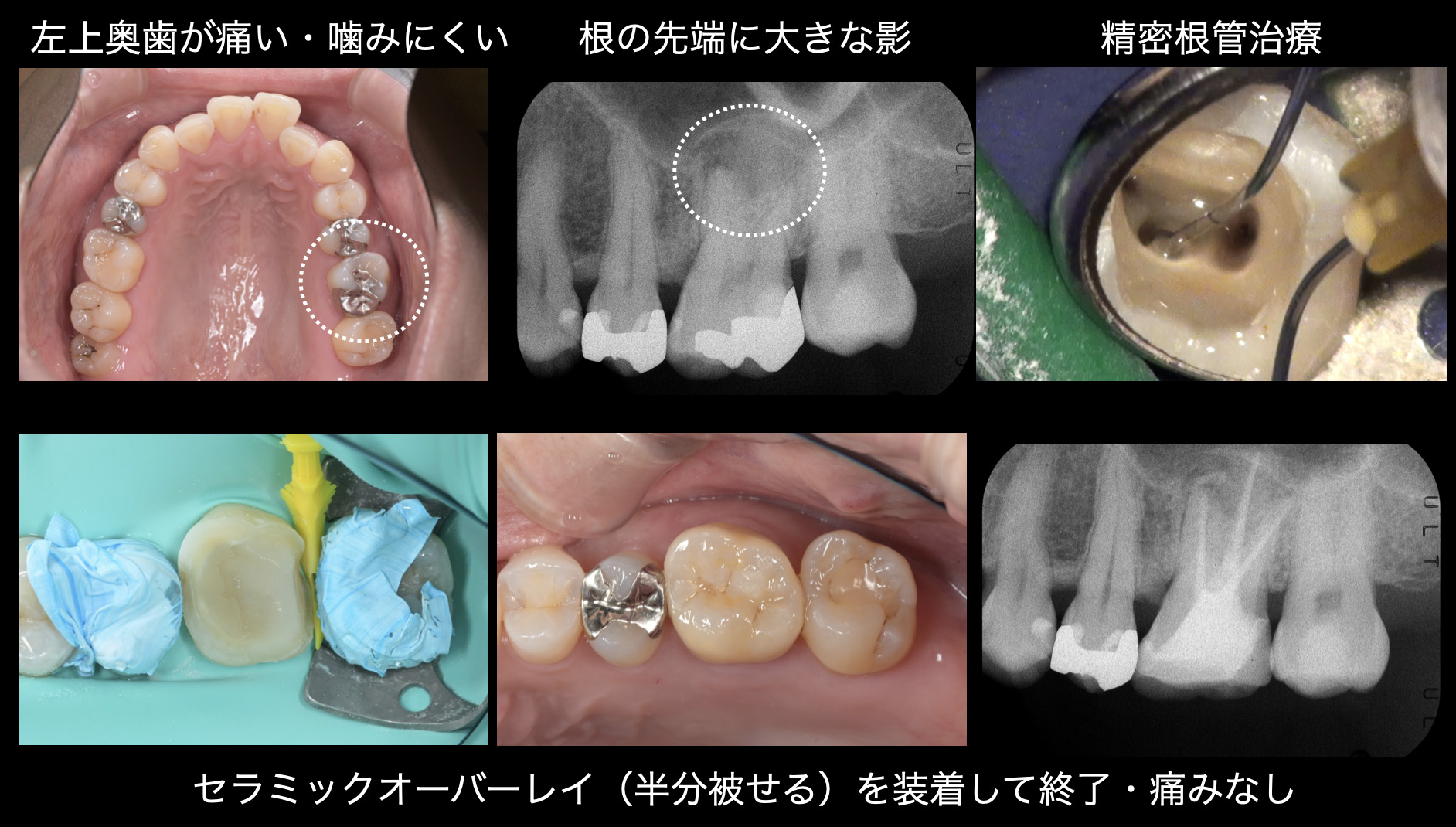 関口歯科 川越、歯医者、歯科医、歯周病、根管治療、入れ歯（義歯）、審美歯科・セラミック治療、自由診療