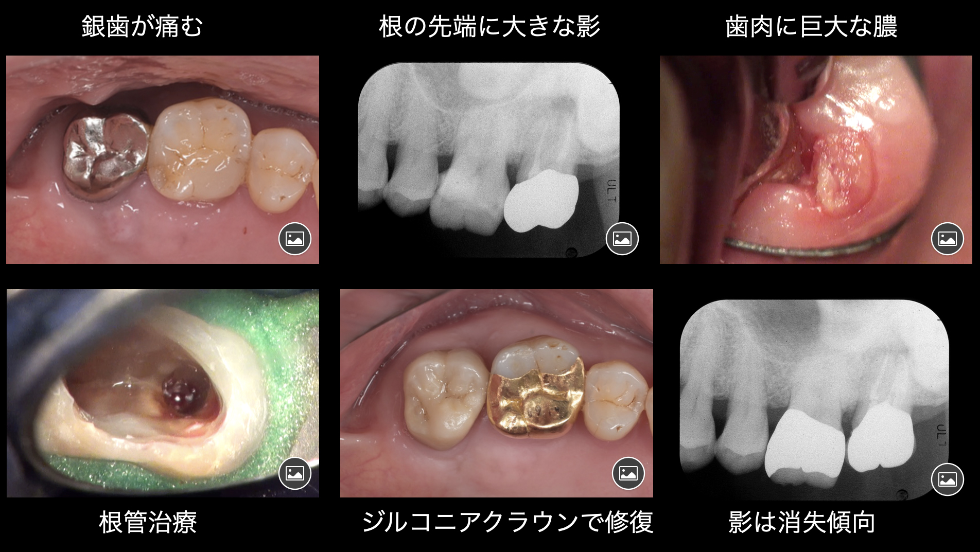 関口歯科 川越、歯医者、歯科医、歯周病、根管治療、入れ歯(義歯)、審美歯科・セラミック治療、自由診療