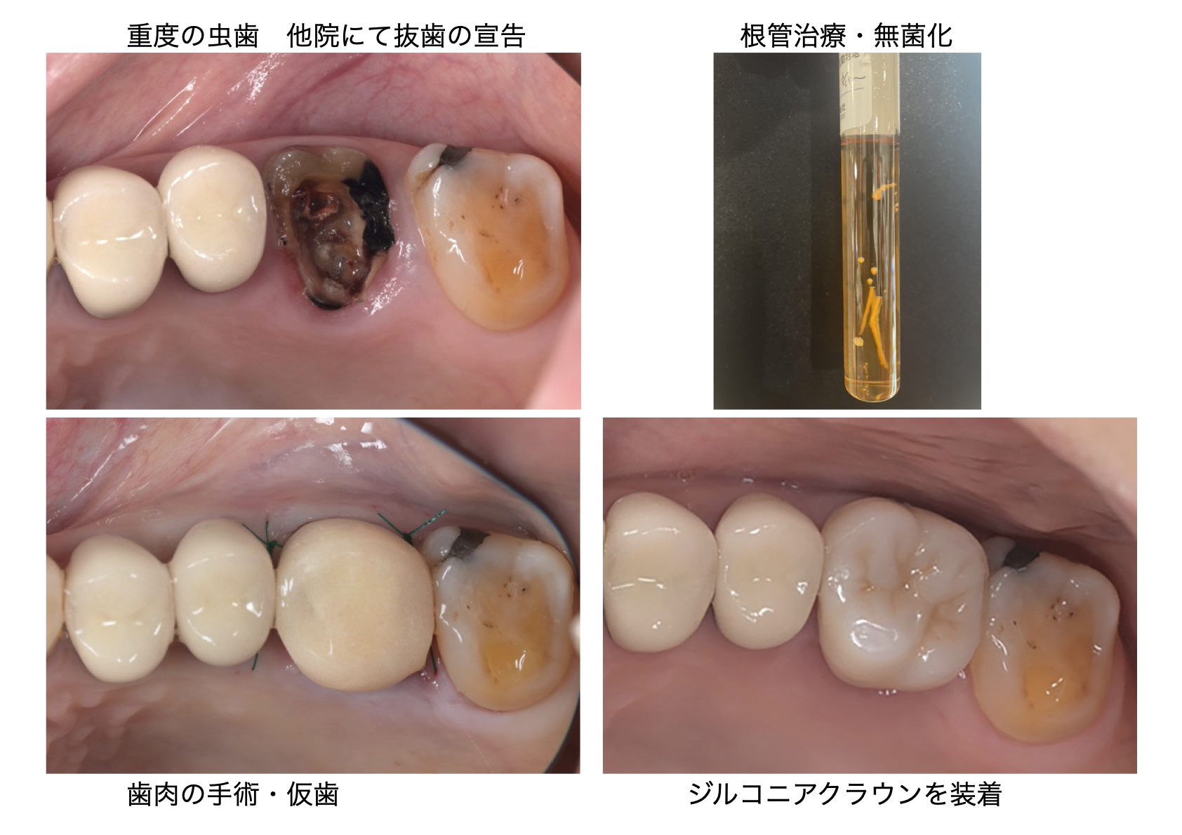 関口歯科 川越、歯医者、歯科医、歯周病、根管治療、入れ歯(義歯)、審美歯科・セラミック治療、自由診療