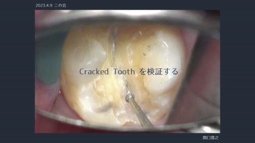 関口歯科 川越、歯医者、歯科医、歯周病、根管治療、入れ歯（義歯）、審美歯科・セラミック治療、自由診療