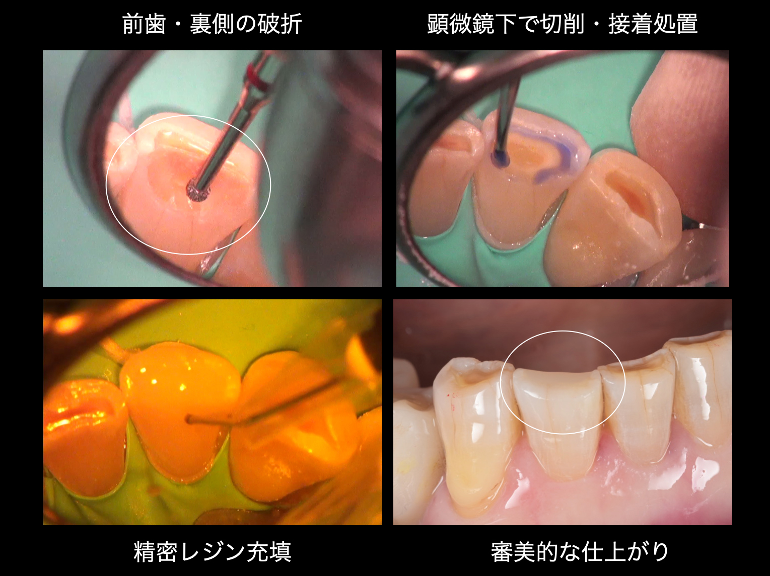 関口歯科 川越、歯医者、歯科医、歯周病、根管治療、入れ歯（義歯）、審美歯科・セラミック治療、自由診療